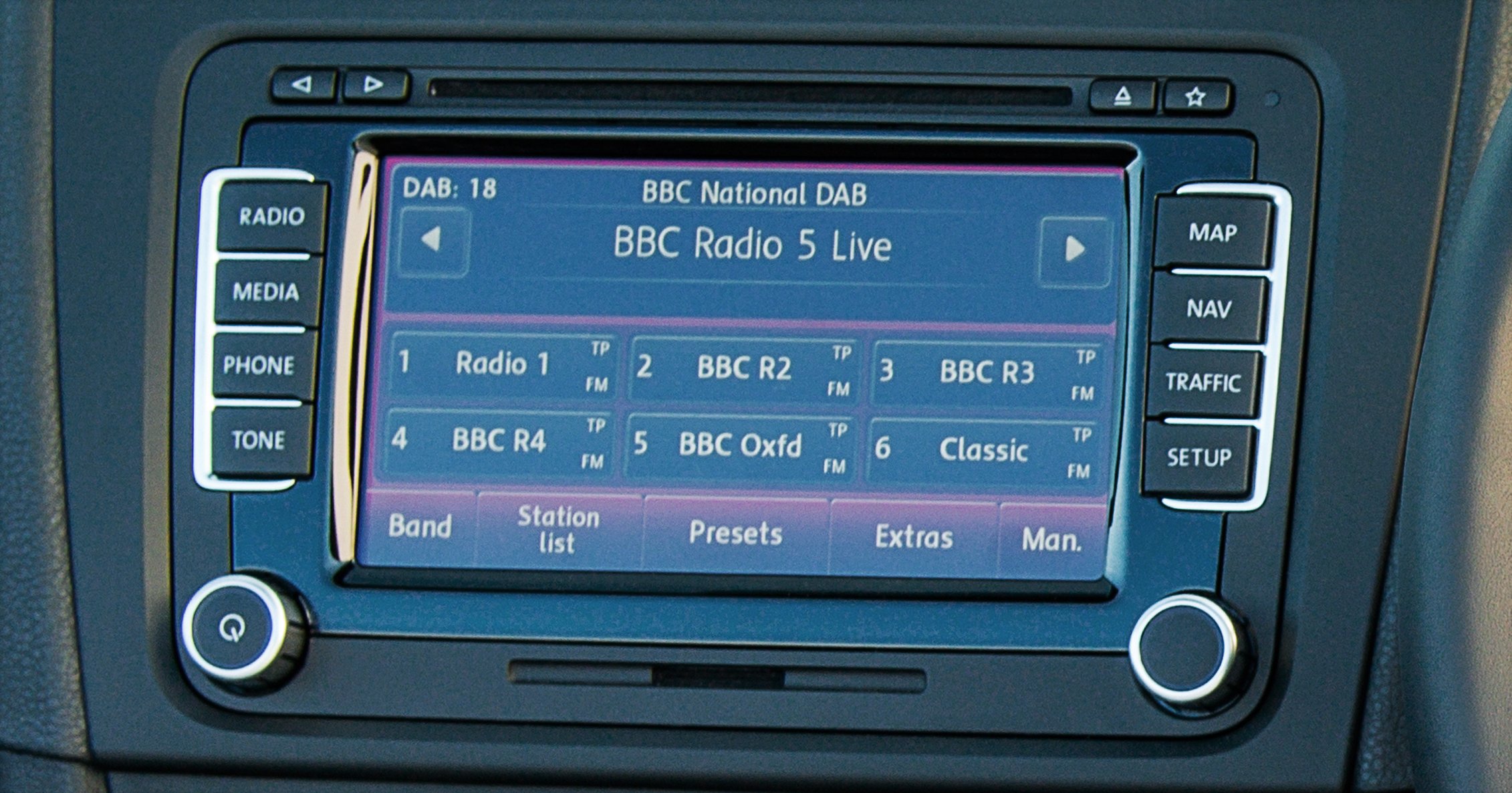 What is DAB digital radio in your car?